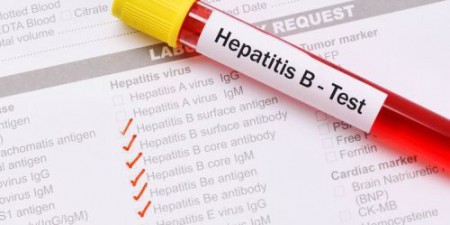 hepatite B